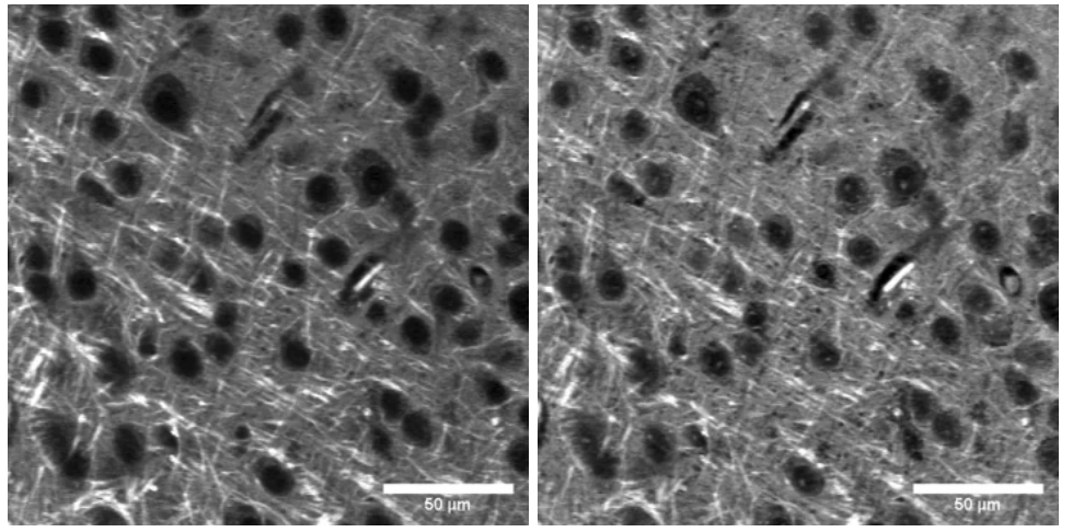 SRS Lock-in Amplifier images of brain samples from University of Washington